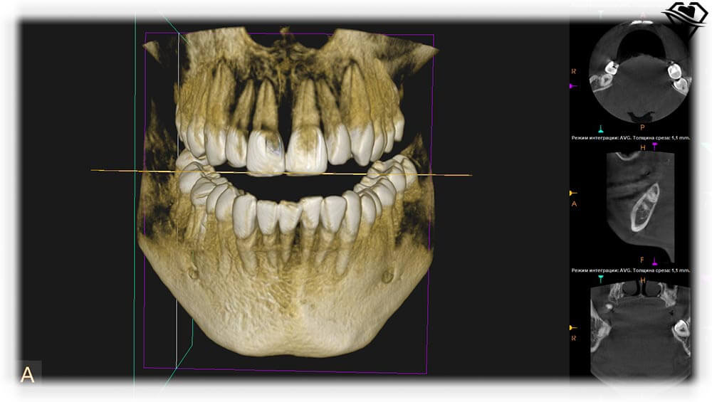 Кт стоматология фото